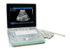 SS-9 Ultrasound B scanner