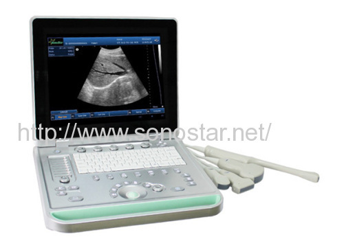 SS-9 Ultrasound B scanner