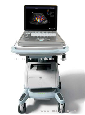 Laptop digital color doppler ultrasound