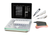 Laptop digital ultrasound Scanner