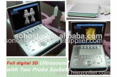3D Digital Ultrasound PC based