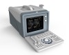 Portable Ultrasound Scanner Machine