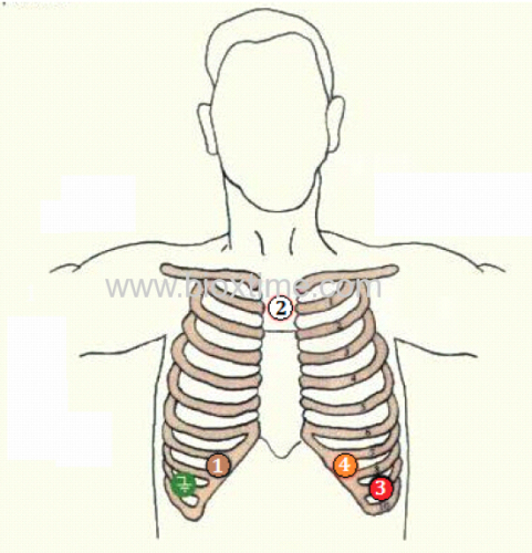 24 hours ECG Holter Recorder Holter Monitor 7 Days Recording iTengo