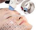 Wrinkle Removal Anti Aging Thermage Fractional RF Equipment Prevent Acne