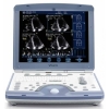 GE Vivid i Portable Ultrasound