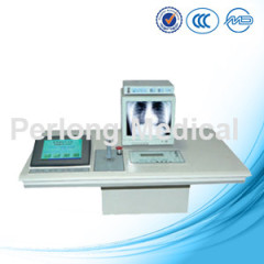 medical x-ray manufacturer by alibaba express