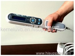 Hot sale uvb phototherapy for vitiligo