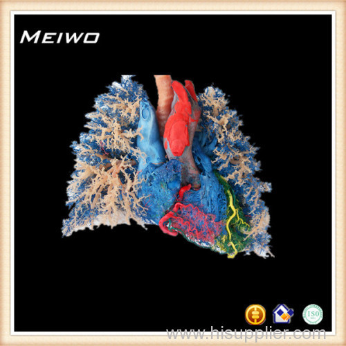 Heart -lung vascular casting specimens plastinated specimens 