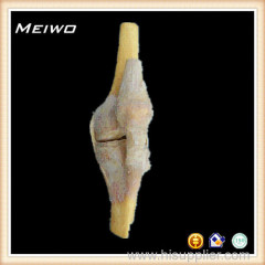 Knee joint preserved specimens for sale