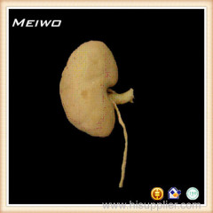 kidney structure antique medical specimens