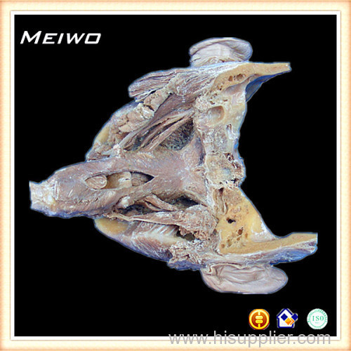 Posterior Pharyngeal muscle plastinated specimens plastinated specimens price