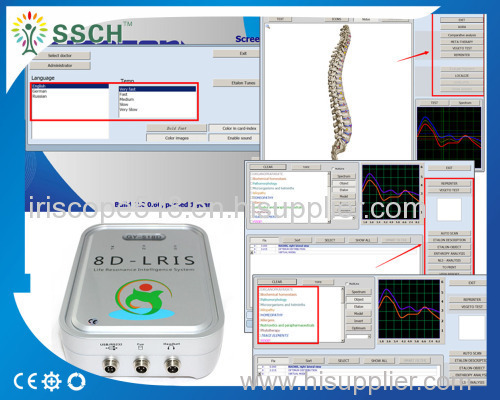 Mini Portable Professional 8D NLS Full Body Sub Health Analyzer with Bioresonance Software