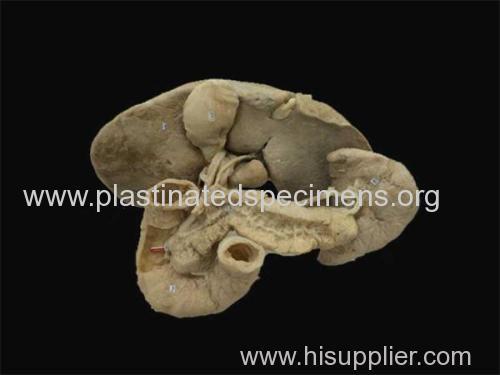 liver spl een pancreas and duodenum plastinated specimens