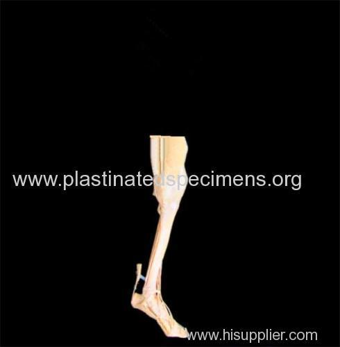 deep muscles of leg and foot plastinated specimens