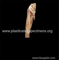 superficial muscles of thigh plastinates of the human body