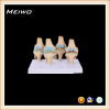 normal and pathologic knee joints set buy anatomy models