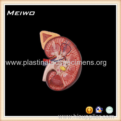 kidney with adrenal gland cheap anatomy models