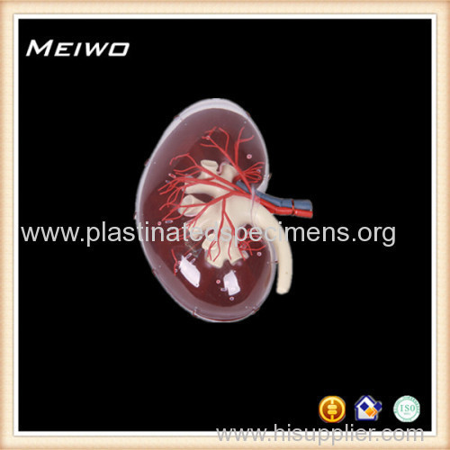 transparent kidney cheap anatomy models