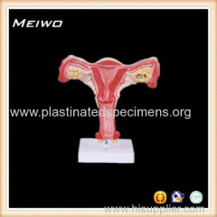 uterus nataural size cheap anatomy models