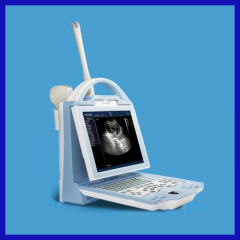 100% Guarantee CE Approved veterinary ultrasound machine 4 Optional probes Ultrasound system warranty