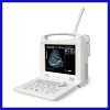 100% Guarantee best price laptop ultrasound machine for Abdomen diagnosis