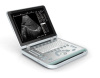 B&W Laptop Ultrasound Scanner