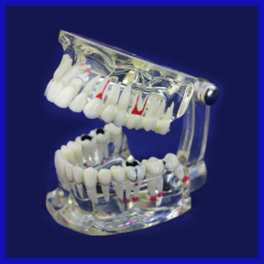OEM service acrylic resin teeth for hospital