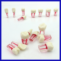 OEM service hospital acrylic denture teeth