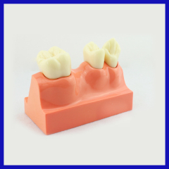 OEM service 4 times tooth body decomposition model