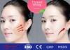Reyoungel Dermal Korea Face PDO Thread Lift Injection Syringe For Double Chin