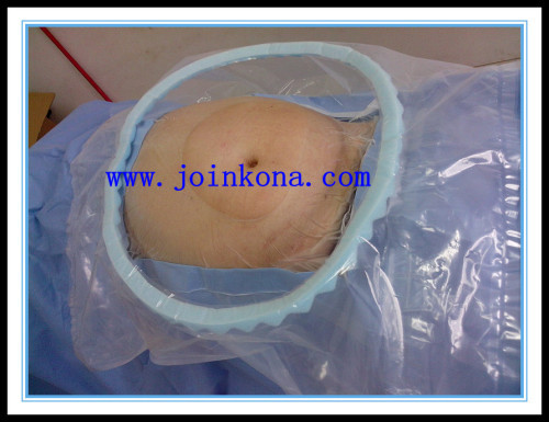 Disposable Caesarean section drape