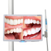 Multimedia Intraoral camera with VGA AV TV PC Media USB 4GB Memory card