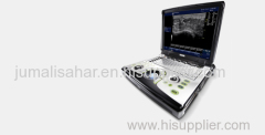 GE Logiq E Ultrasound Machine With A 1 Year Warranty