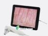 Portable LED Screen Hair detecting And Skin Analyzer Machine Without PC
