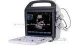 15'' LCD Screen Portable color Doppler ultrasound with stable image performance