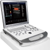 Cheap 3D laptop Color Doppler Ultrasonic Scanner/doppler ultrasound for sale