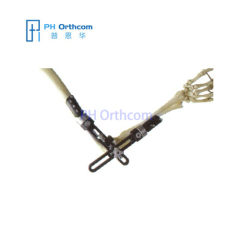 Elbow External Fixator Orthofix Type External Fixator Trauma Orthopaedic