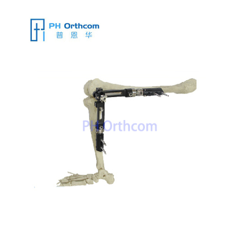 Knee Fixator with ProCallus Straight Clamps Orthofix Type Trauma Orthopaedic
