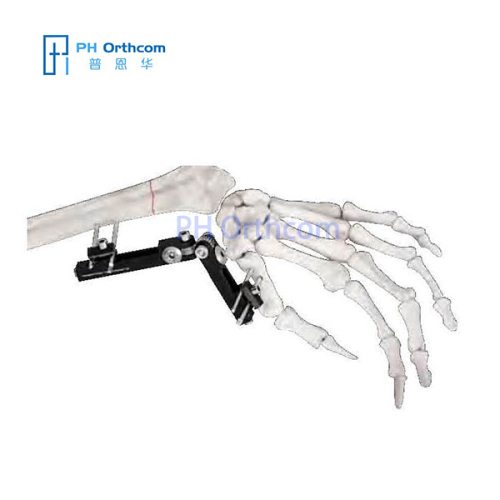Multiplanar Minirail External Fixator Orthofix Type Mini Fragement Finger External Fixator Trauma Orthopaedic