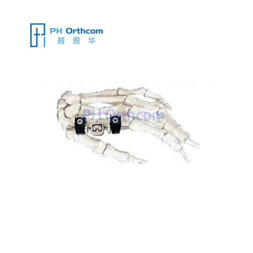 Standard Penning MiniFixator Orthofix Type Mini Fragment Finger External Fixator Trauma Orthopaedic