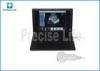 B type portable Hospital Medical Ultrasound Machine Laptop PC base