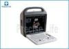 3D/4D Color Ultrasound System Ultrasonic Color Image Doppler Scanner