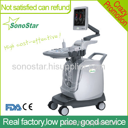 SS-2000 Sonostar cheap trolley doppler ultrasound machine color ultrasound scanner
