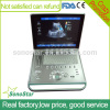 C5 Sonostar 4D portable ultrasound diagnostic devices portable ultrasound equipment