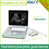 SS-7 Portable Ultrasound Machine PriceLaptop Ultrasound Scanner