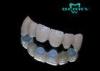 Peek Optima and BioHPP Material Crown no any Allergy Permanent dental prosthesis