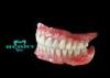 Safety BioHpp Crown Good for the Gingiva after restoration