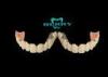Implantable Telescope Crown restoring your perfect mouth state