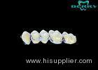 High Noble Palladium Silver PFM Dental Crown without discoloration
