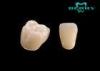 Ultra-streng and Beautiful Ceramic Crown For Teeth Cercon CAD Zirconia